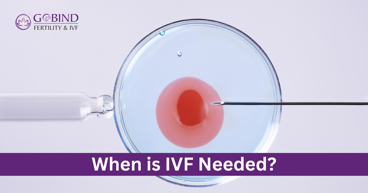 When IVF is needed