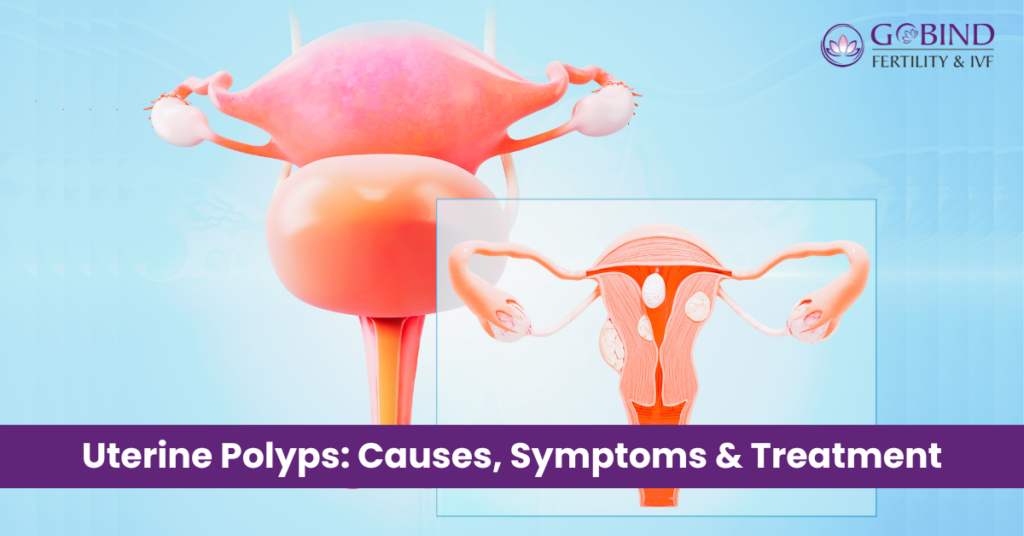  Picture is showing a uterus having Polyp called Uterine Polyp