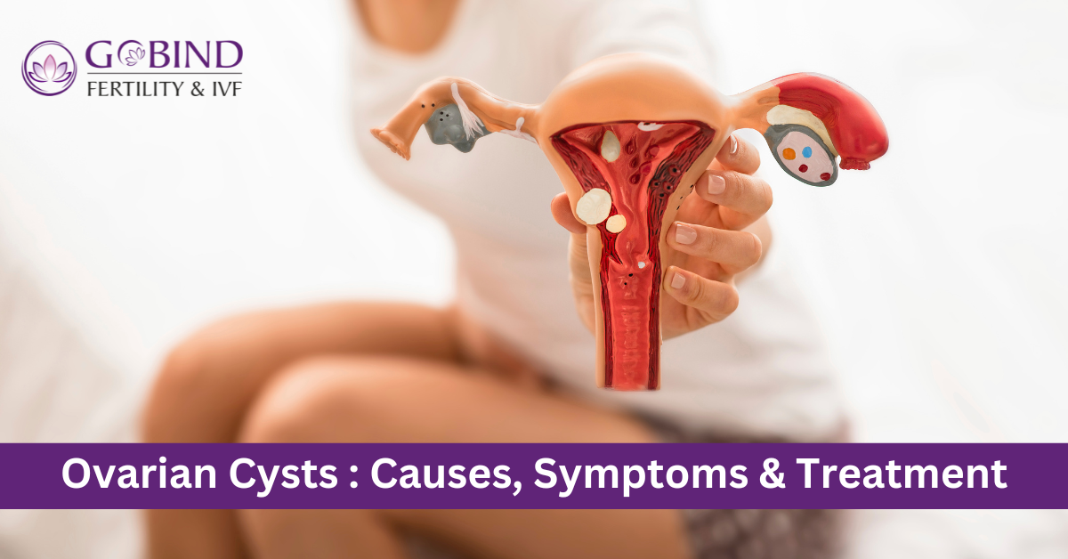 Ovarian Cysts: causes, treatment and symptoms