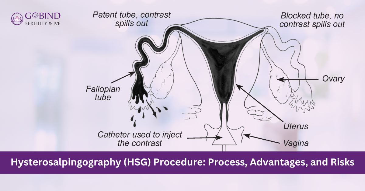 Hysterosalpingography Process, Risks and Advantages