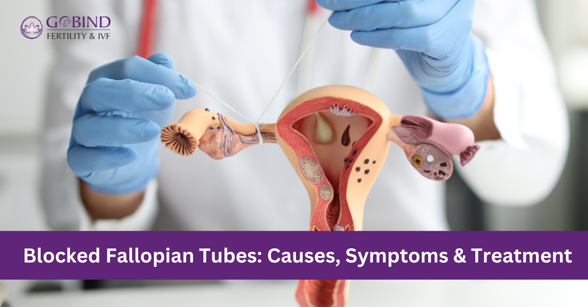 An Expert Insight by Gobind Fertility and IVF Centre on Blocked Fallopian Tubes