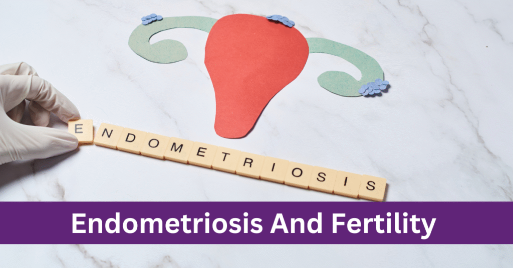 Endometriosis and Fertility