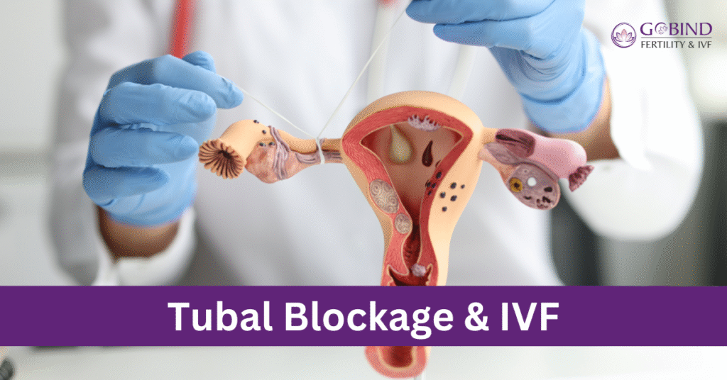 Tubal Blockage and IVF: Is it the Best Option Described By Dr Manju khurana at Gobind Fertility & IVF centre